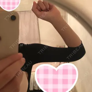 2日目の経過画像（2枚目）
