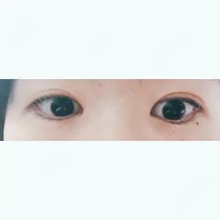 216日目の経過画像（2枚目）