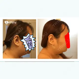 7日目の経過画像（2枚目）