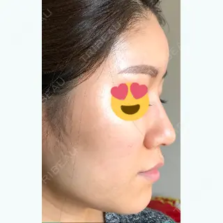 2日目の経過画像（2枚目）