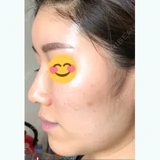 2日目の経過画像（3枚目）