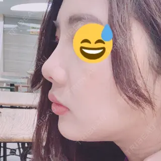 2日目の経過画像（2枚目）