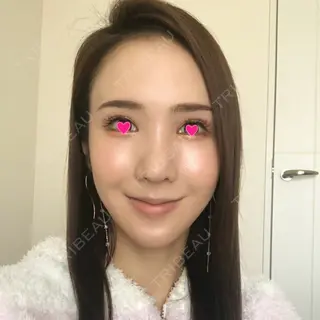 39日目の経過画像（1枚目）