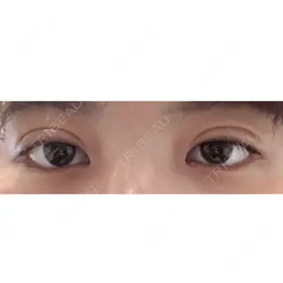 10日目の経過画像（1枚目）