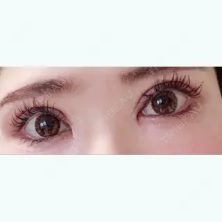 11日目の経過画像（1枚目）