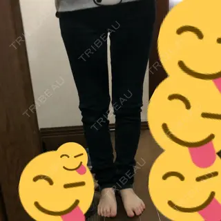7日目の経過画像（3枚目）