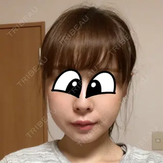 24日目の経過画像（1枚目）