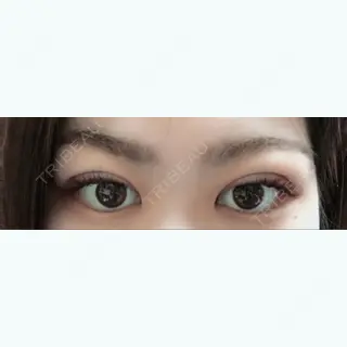 3日目の経過画像（3枚目）