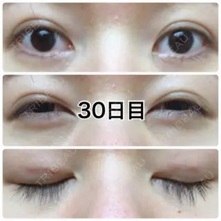 30日目の経過画像（1枚目）