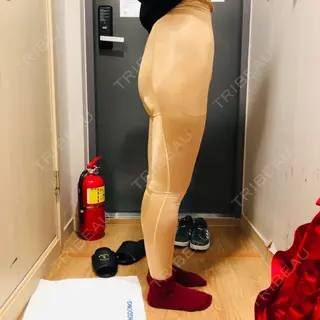 0日目の経過画像（3枚目）