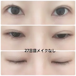 27日目の経過画像（1枚目）
