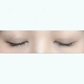 19日目の経過画像（2枚目）
