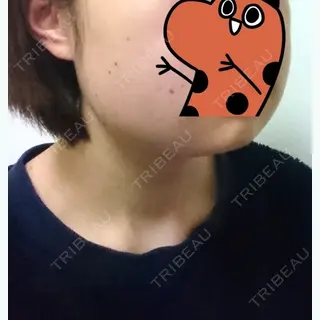 2日目の経過画像（2枚目）