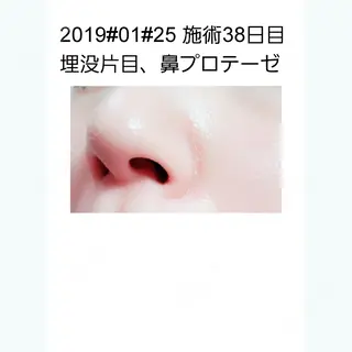 38日目の経過画像（1枚目）