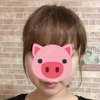 27日目の経過画像（1枚目）