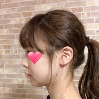 27日目の経過画像（3枚目）