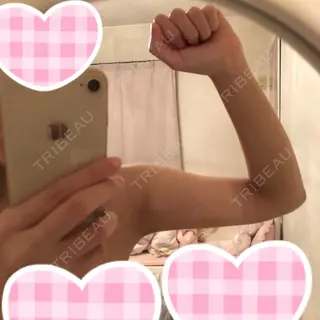 8日目の経過画像（2枚目）