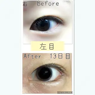 13日目の経過画像（3枚目）