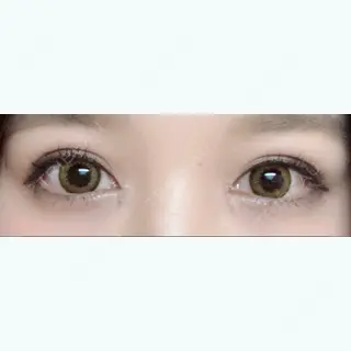 20日目の経過画像（1枚目）