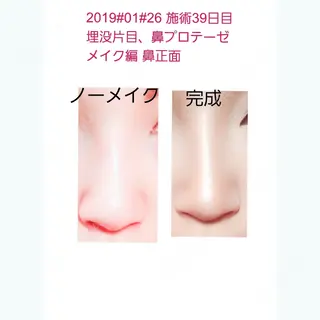 40日目の経過画像（1枚目）