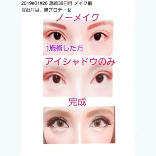 40日目の経過画像（1枚目）