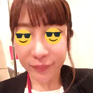 58日目の経過画像（1枚目）