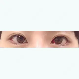 9日目の経過画像（1枚目）