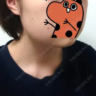 7日目の経過画像（2枚目）