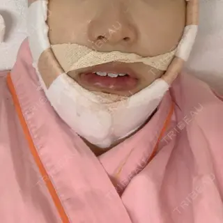 0日目の経過画像（2枚目）