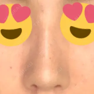 3日目の経過画像（1枚目）