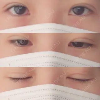 10日目の経過画像（1枚目）