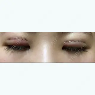 2日目の経過画像（2枚目）