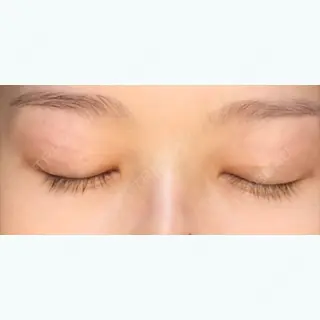 50日目の経過画像（2枚目）