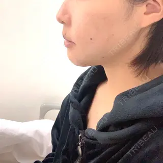3日目の経過画像（1枚目）