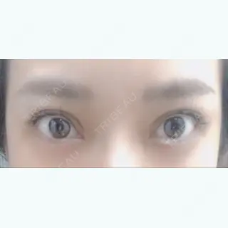 42日目の経過画像（1枚目）