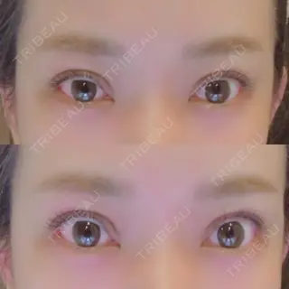 52日目の経過画像（1枚目）