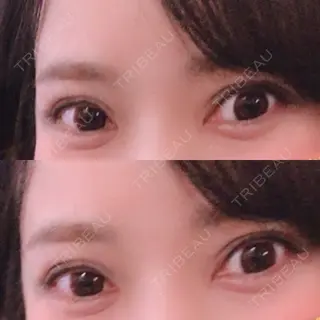 53日目の経過画像（1枚目）