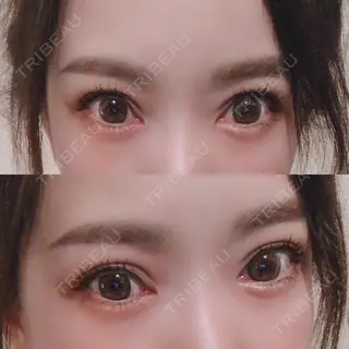 74日目の経過画像（2枚目）