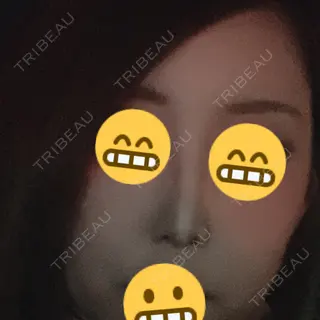 786日目の経過画像（1枚目）