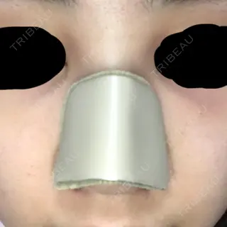 2日目の経過画像（1枚目）