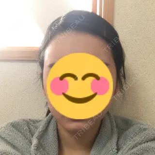 49日目の経過画像（1枚目）