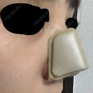 3日目の経過画像（2枚目）