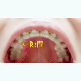 985日目の経過画像（2枚目）