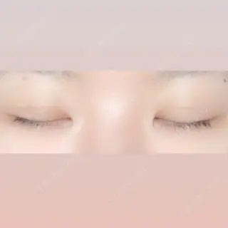 3日目の経過画像（2枚目）