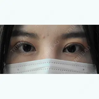 21日目の経過画像（2枚目）