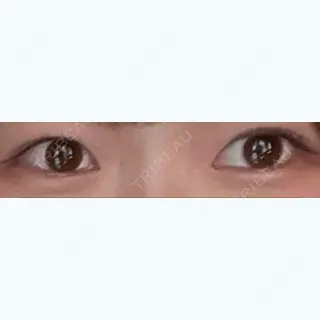 4日目の経過画像（1枚目）