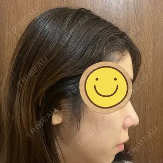 7日目の経過画像（2枚目）