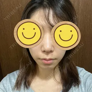 8日目の経過画像（1枚目）
