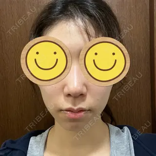 9日目の経過画像（1枚目）