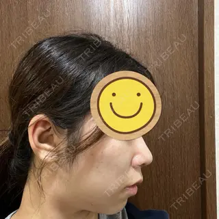 9日目の経過画像（2枚目）